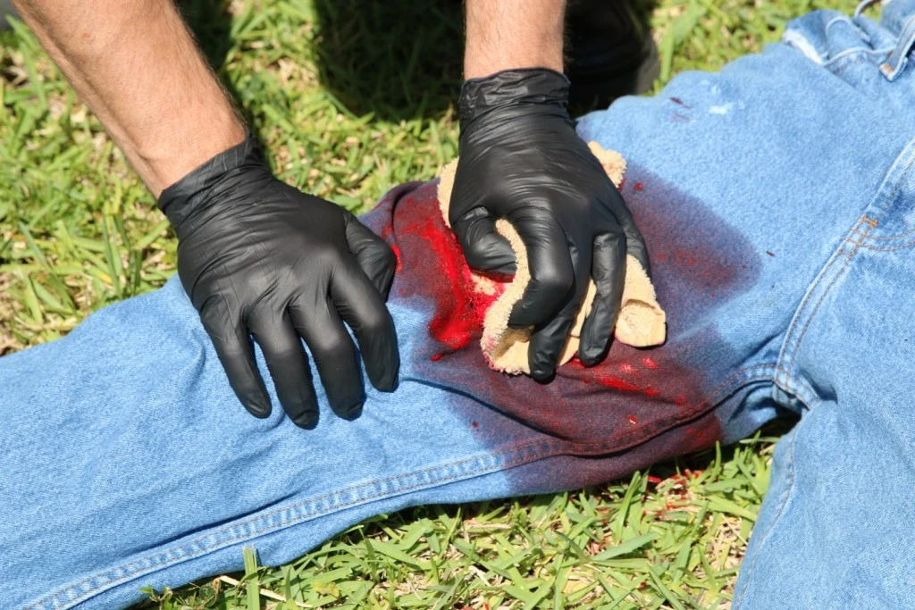 První pomoc – střelná poranění